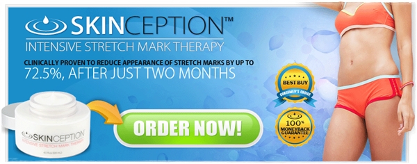 buy skinception stretch mark cream