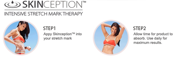 skinception stretch mark cream price
