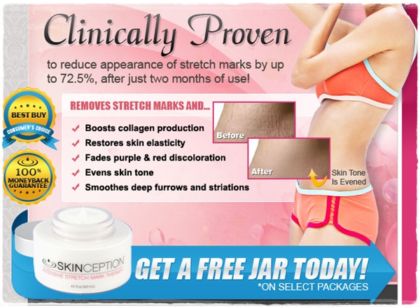 skinception stretch mark cream