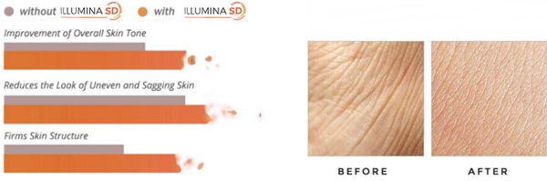 illumina sd anti-aging cream