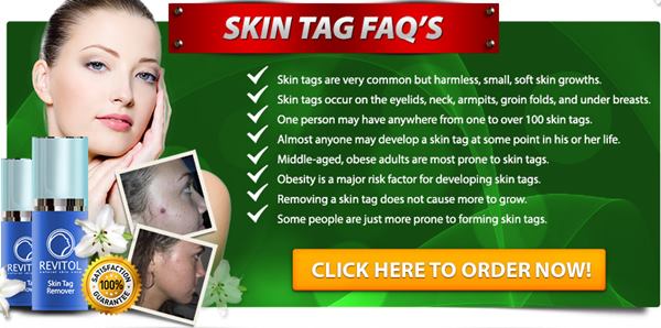 buy revitol skin tag removal cream