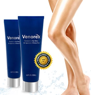 venorex varicose vein treatment